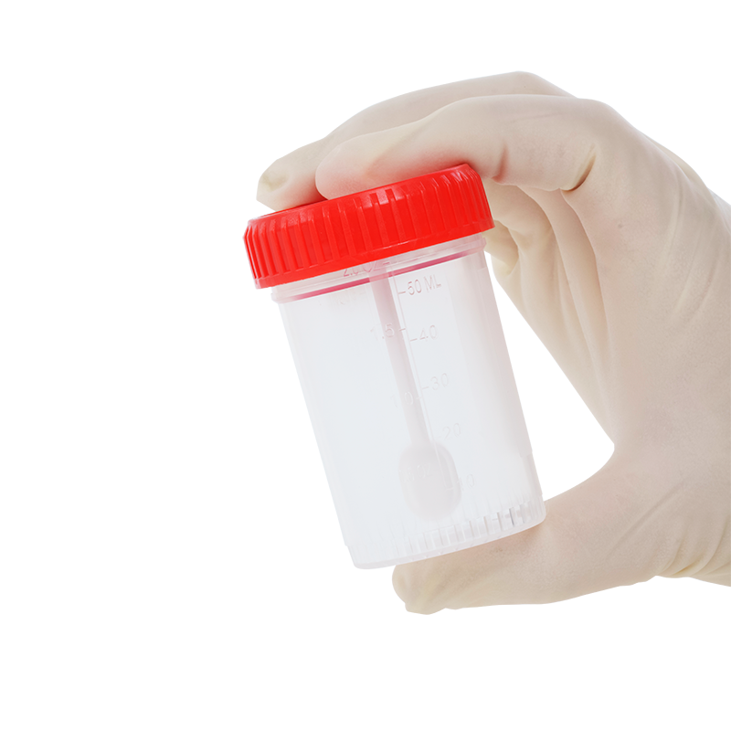 Dynarex Stool Specimen Container with Spoon, 60mL (400 Count)