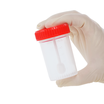 Dynarex Stool Specimen Container with Spoon, 60mL (400 Count)