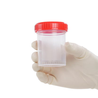 Dynarex Specimen Container, Non-Sterile