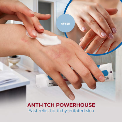 MedPride Hydrocortisone Cream 1% Dermatitis Cream Anti Itch Cream for Itchy Skin Relief, 1oz. Tubes - Indv. Boxed - 72/cs.