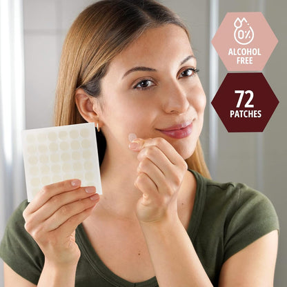 Medpride Hydrocolloid Acne Patches - 12mm Dots, Sterile Pimple Patches For Face & Body Zits, Alcohol-Free - 72/Box, Case of 48 (3456 Count)